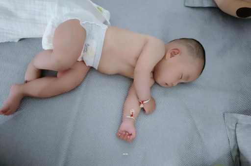 威海宝宝脸上有白色斑块